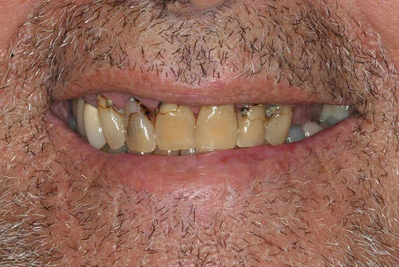 Before