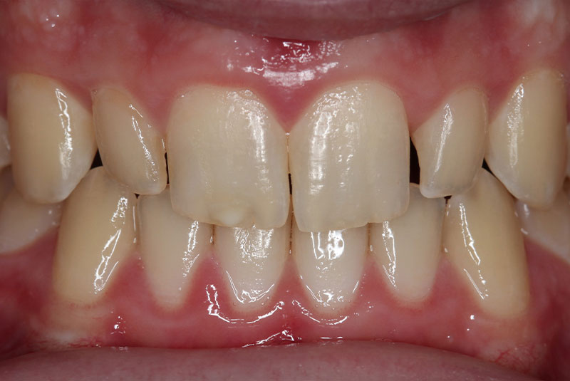 Before