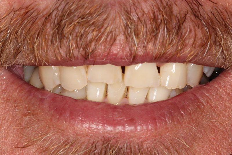 Before