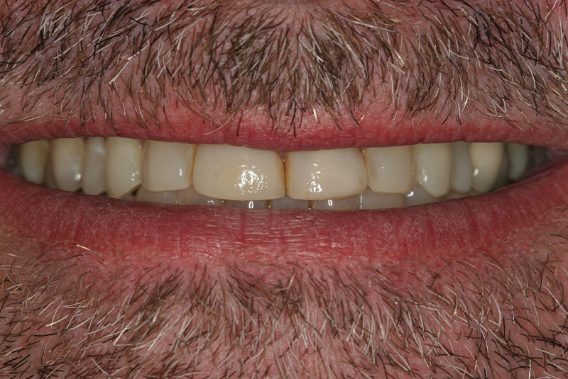 Before