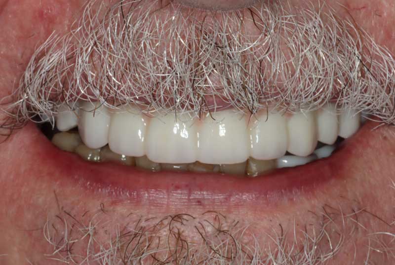 After