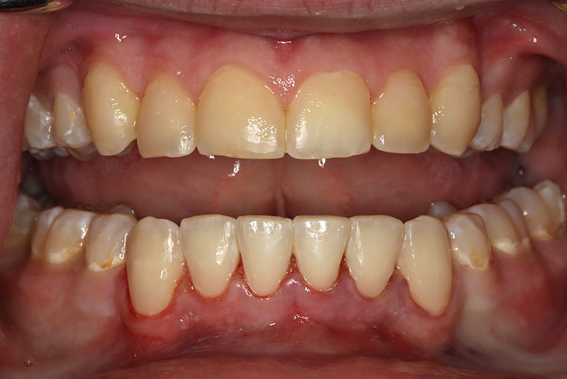 After